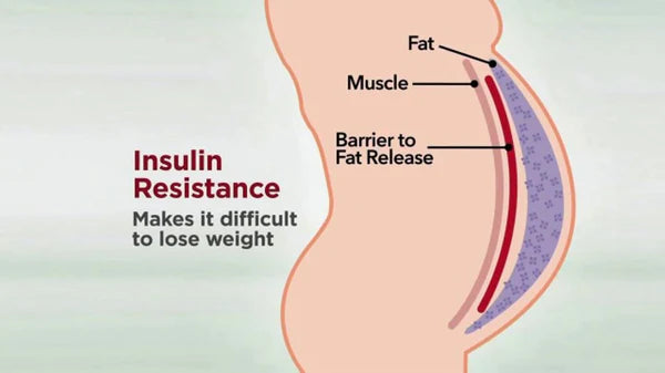 Insulin Resistance and Weight Loss